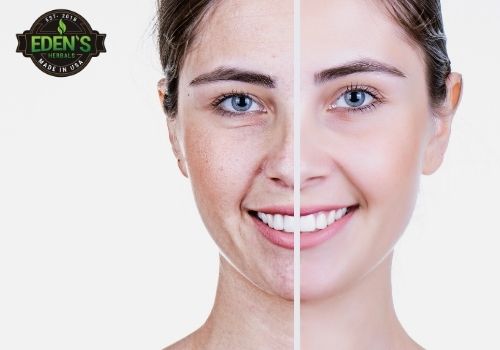 Woman before and after using CBD for anti-aging