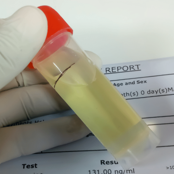 Does CBD Isolate show on Drug test?
